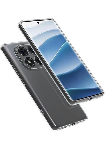 Xiaomi Redmi Note 14 Pro Plus 5g Uyumlu Kılıf Şeffaf Soft Silikon Kılıf Şeffaf modelleri