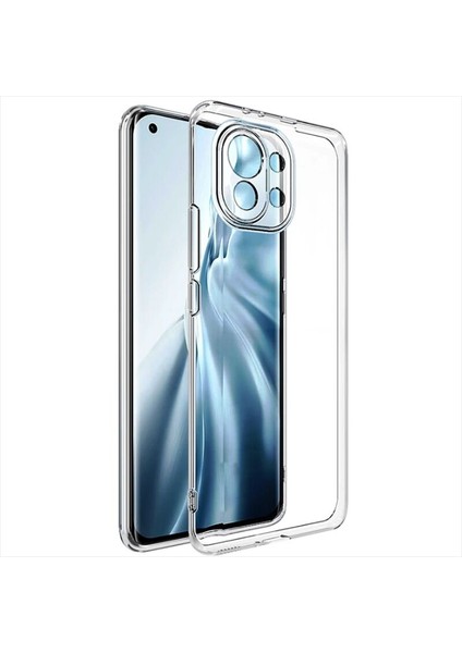 Xiaomi Mi 11 Lite 5g Uyumlu Kılıf Zebana Şeffaf Soft Silikon Kılıf Şeffaf