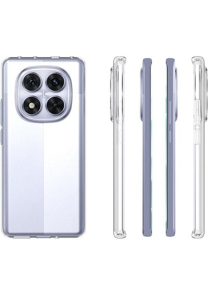 Xiaomi Redmi Note 14 Pro 5g Uyumlu Kılıf Şeffaf Soft Silikon Kılıf Şeffaf modelleri
