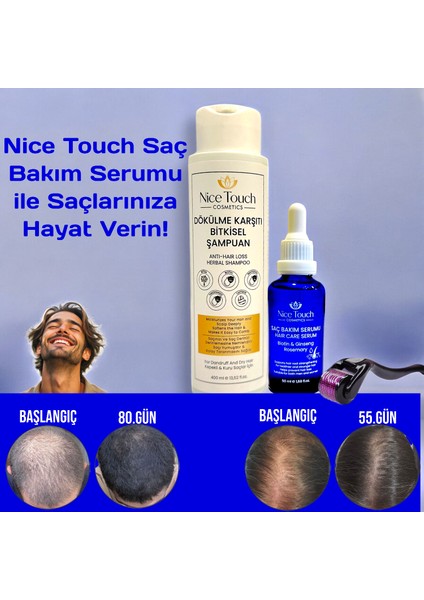 NİCE TOUCH KOZMETİK1 Adet Saç Serum , Saç Vitamini+ 1 Adet Dermarroler+1 Adet Şampuan