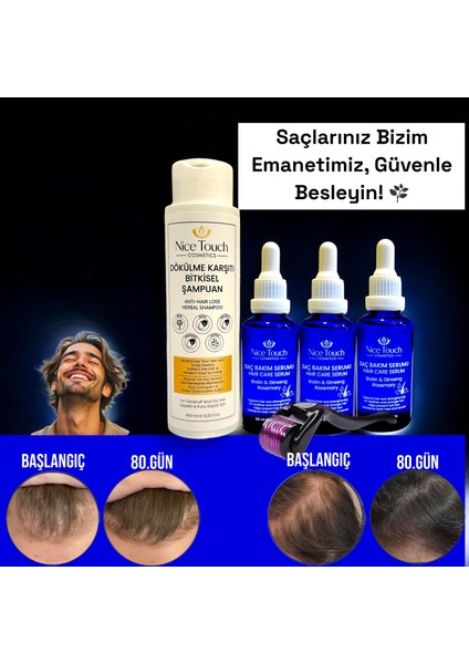 NİCE TOUCH KOZMETİK 3 Adet Saç Serum , Saç Vitamini+ 1 Adet Dermarroler+ 1 Adet Şampuan