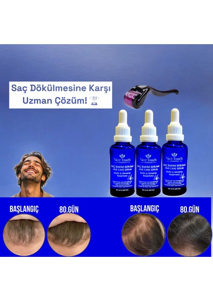 NİCE TOUCH KOZMETİK3 Adet Saç Serum , Saç Vitamini+ 1 Adet Dermarroler
