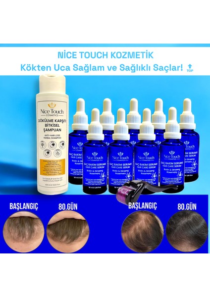 NİCE TOUCH KOZMETİK 9 Adet Saç Serumu , Saç Güçlendiriçi, Saç Vitamin Bombası+ 1 Adet Dermaroller+ 1 ADET BİTKİSEL Şampuan