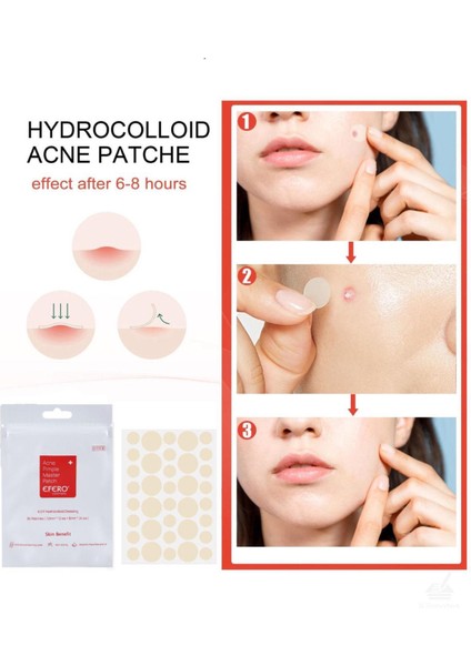 Akne Pimple Temizleme Bandı - Acne Pimple Patch