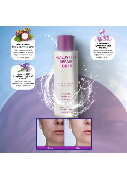 Hyalusteen Repair Toner Onarıcı Bakım Tonik ve Yenileyici Hyaluronic Acid Kore 150ml fırsatları