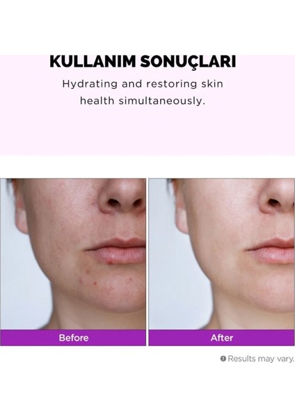 Hyalusteen Repair Toner Onarıcı Bakım Tonik ve Yenileyici Hyaluronic Acid Kore 150ml indirimleri
