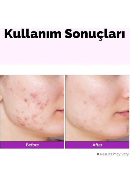 Hyalusteen Repair Emulsion Cilt Nemlendirici Onarıcı Ve Yenileyici Emülsiyon Krem Kore 120ml fırsatları