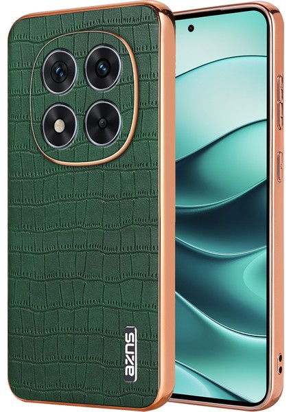 Xiaomi Redmi Note 14 Pro Plus 5g Galvanik Timsah Dokulu Pu+Tpu Telefon Kapağı (Yurt Dışından)