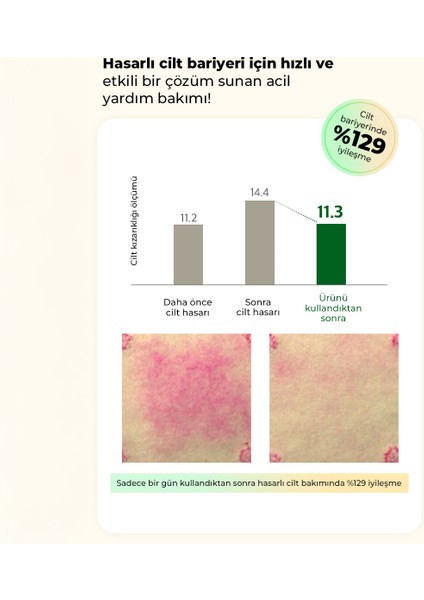 Aqua Cica Pure Shot Serum Bariyer Nemlendirici Yatıştırıcı Mist Serum Kore 100ml