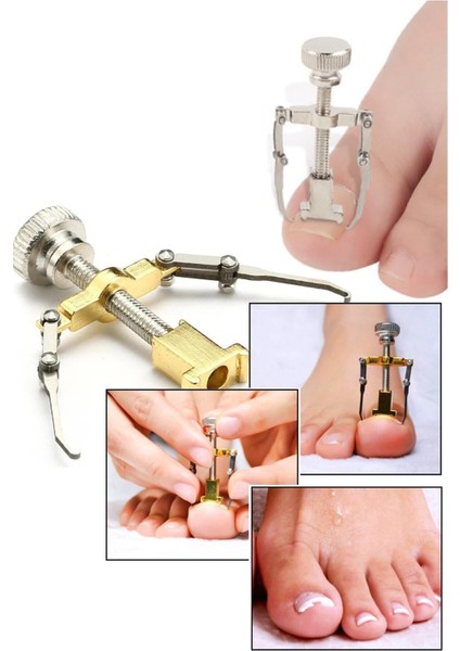 Batık Tırnak Çıkartıcı Ayak Tırnak Düzeltici Pens Aparat fiyatları