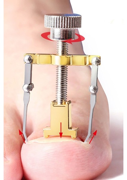 Batık Tırnak Çıkartıcı Ayak Tırnak Düzeltici Pens Aparat modelleri