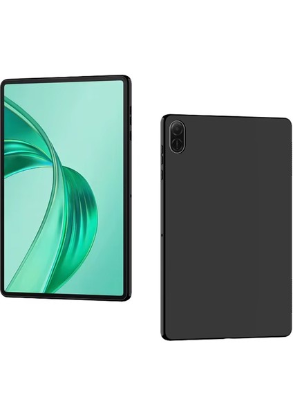 Honor Pad X8A 11 Inch Tablet Silikon Tpu Soft Kılıf -AL3284