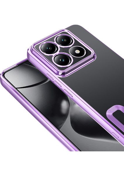 Xiaomi 14T Pro Kılıf Kamera Korumalı Logo Gösteren Omega Kapak fiyatları