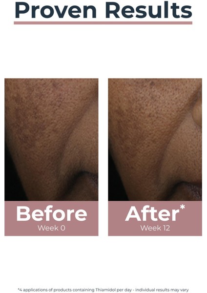 Anti-Pigment Spot Corrector 5ml modelleri