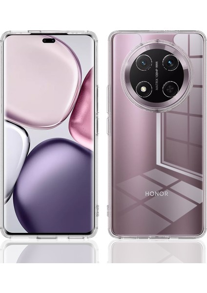 Honor Magic7 Lite 5g Şeffaf Telefon Kılıfı Tpu + Akrilik Darbeye Dayanıklı Telefon Arka Kapak (Yurt Dışından)