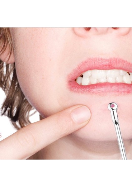 4 Adet/takım Siyah Nokta Komedon Akne Tahıl Kusur Vakum Çıkarıcı Siyah Nokta Çıkarıcı Aracı Kaşık Cilt Bakımı Için (Yurt Dışından) fiyatları