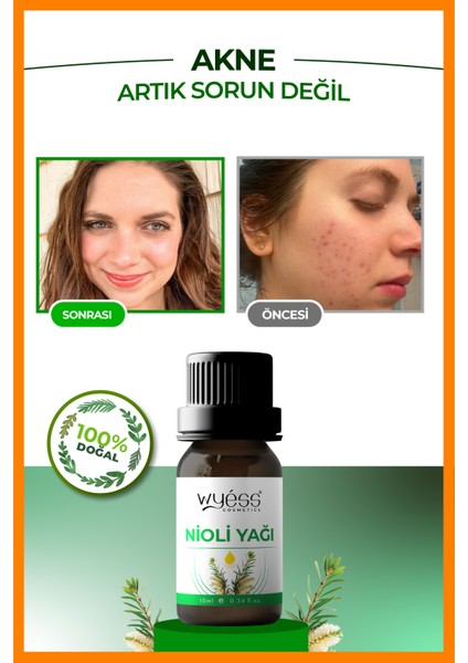Nioli Yağı- Genital Bölge Hijyen Desteği ve Koku Önleyici Saf ve Doğal 10 ml