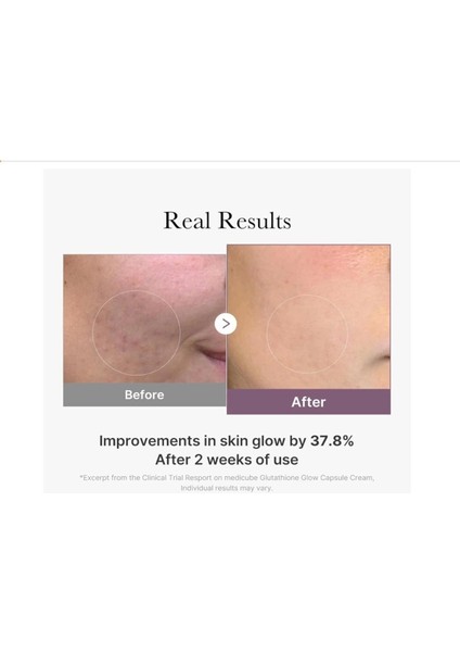 Age-R Glutathione Glow Capsule Cream 50ml Yüz Kremi