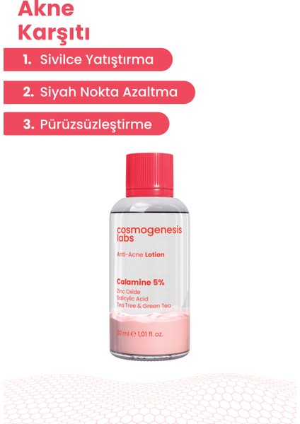 Akne Karşıtı Losyon 30ml – Akne Yatıştırıcı, Siyah Nokta Azaltıcı Vegan (%5 Calamine – Yeşil Çay)