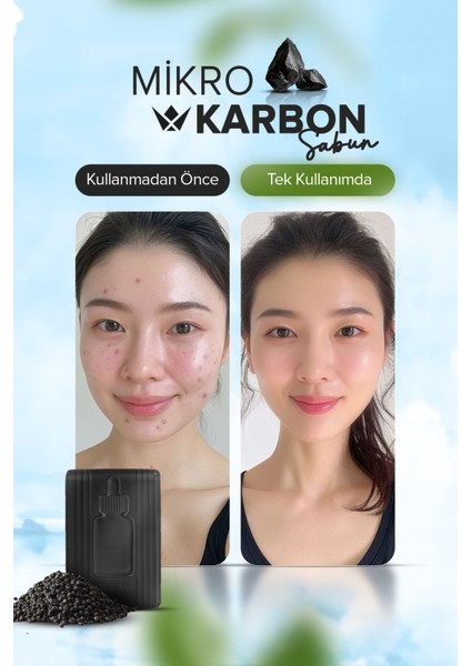Mikro Karbon Sabunu 100 gr