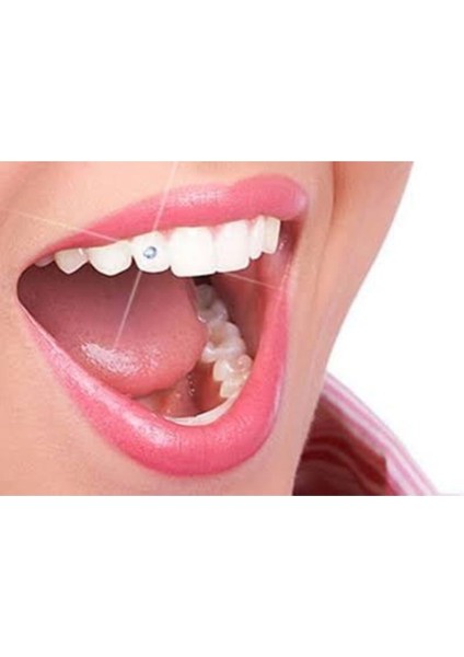 Diş Taşı Diş Pırlantası