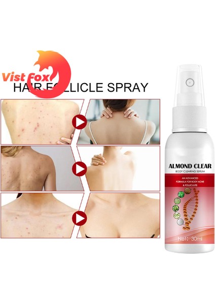 Vist Fox Temizle Vücut Özü Kaşıntıyı Giderir Badem Temizle Vücut Temizleme Özü (Yurt Dışından) fırsatları