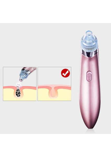 Güzellik Cihazı Gözenek Temizleyici Siyah Nokta Ingilizce Sürüm Temizleme Cihazları Gül Altın Pil (Yurt Dışından) modelleri