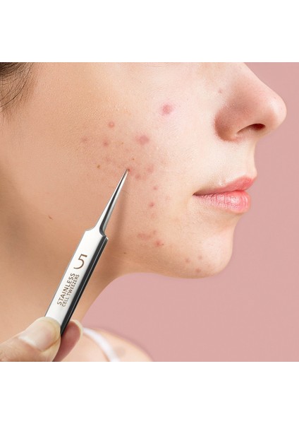 Alman Ultra-Ince No. 5 Klip Siyah Nokta Remover Akne Iğne Aracı Cımbız Sivri Ipuçları Kaşlar Cımbız Güzellik Salonu (Yurt Dışından) fiyatları
