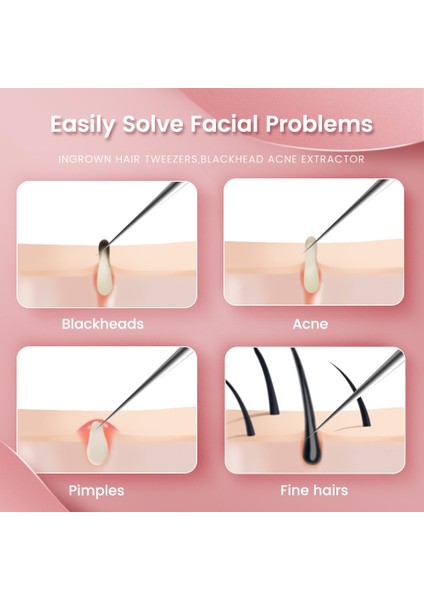 Alman Ultra-Ince No. 5 Klip Siyah Nokta Remover Akne Iğne Aracı Cımbız Sivri Ipuçları Kaşlar Cımbız Güzellik Salonu (Yurt Dışından) modelleri