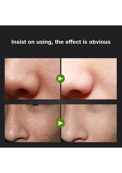 Bambu Siyah Nokta Maskesi (Yurt Dışından) indirimleri