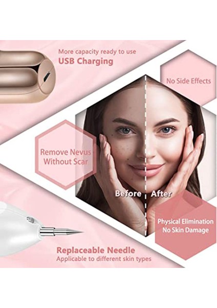 Taşınabilir Güzellik Ekipmanları Ayarlanabilir Cilt Etiketi Sökücü Çok Hız Seviyesi Cilt (Yurt Dışından) fırsatları