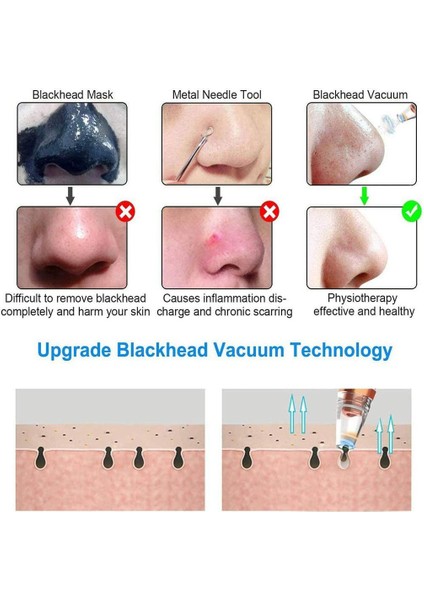 Akne Sökücü Elektrikli Gözenek Temizleyici Çok Fonksiyonlu Siyah Nokta Temizleyici (Yurt Dışından) fırsatları