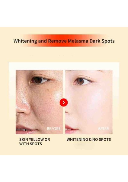 Süper Brightening Krem Ekstra Beyazlatma ve Çil Giderici 20 gr fırsatları