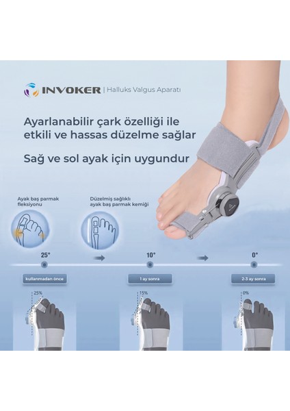 Ayarlı Halluks Bunyon Ayak Baş Parmak Kemik Eğriliği Düzeltme Aparatı Gece Ateli 3 Lü Set