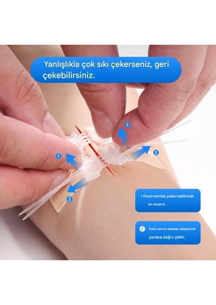 Acil Yara Kapatıcı - 2 Adet Ameliyatsız Dikiş Bandı, Kolay Kullanım, Hızlı Iyileşme