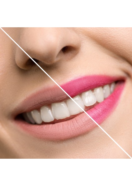 İnuwet Çiçek Detaylı Dudak Nemlendiricisi-Limon Kokulu fiyatları