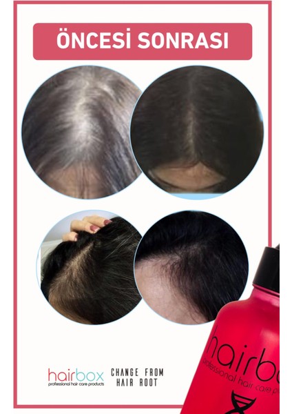 HAİRBOX Kadın Saç Serum, Saç Serumu ( 1 Serum ) fırsatları