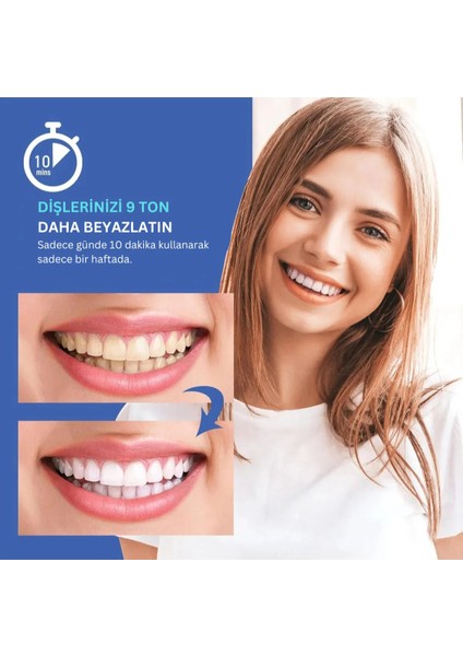 Luelli 35% Karbamid Peroksit Diş Beyazlatma Kiti | Uv Led Işık, Diş Beyazlatıcı Jel, Diş Lekesi Giderici fiyatları