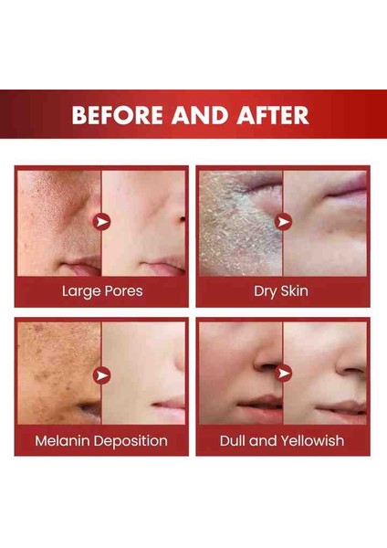 Ejderha Kanı Bitkisi Yüz Kremi (Collagen, Vitamin E,b3,b5,retinol) 50G fiyatları