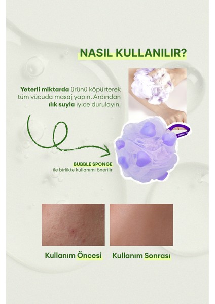 Akneye Eğilimli Ciltler İçin Vücut Yıkama Jeli KUNDAL Tea Treebiotics Acne Body Wash 500ml