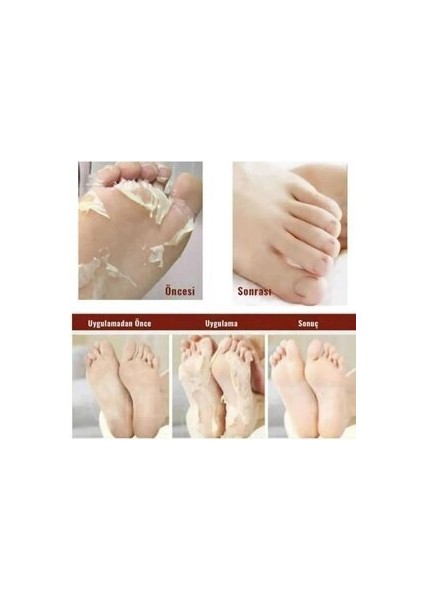 Ayak Soyucu Çorap Ölü Derileri Soyan Ayak Çorabı Peeling Maskesi