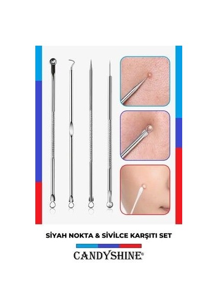 Paslanmaz Çelik Komedon Iğne Aracı Çıkartıcı Set Yüz Bakımı Siyah Nokta Leke Çıkarıcı