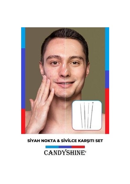 Paslanmaz Çelik Komedon Iğne Aracı Çıkartıcı Set Yüz Bakımı Siyah Nokta Leke Çıkarıcı fırsatları