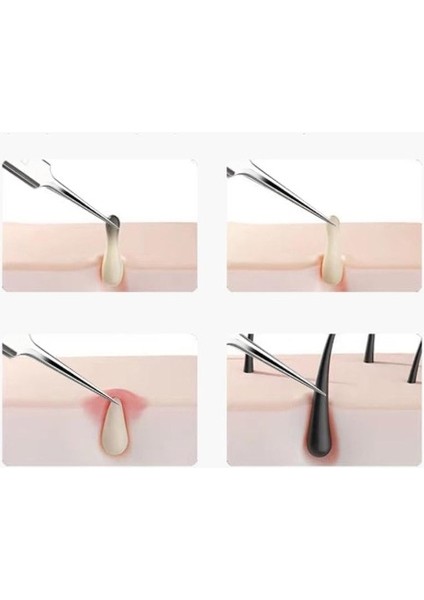 Paslanmaz Çelik 3lü Siyah Nokta Çıkarma Cımbızı Aleti Takımı Siyah Nokta Temizleyici Profesyonel Yüz Siyah Nokta Sökücü Cımbız Hassas Çıkarıcı Akne Temizleme Kiti Popper Araçları modelleri