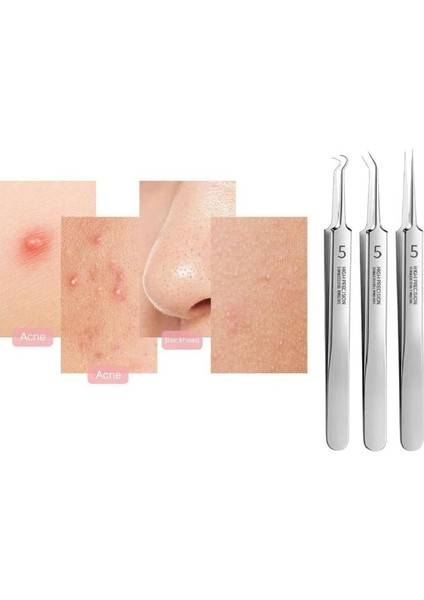 Paslanmaz Çelik 3lü Siyah Nokta Çıkarma Cımbızı Aleti Takımı Siyah Nokta Temizleyici Profesyonel Yüz Siyah Nokta Sökücü Cımbız Hassas Çıkarıcı Akne Temizleme Kiti Popper Araçları fırsatları