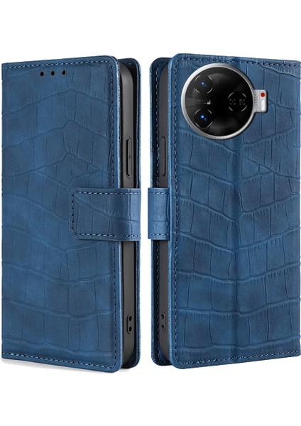 Tecno Camon 30 Pro 5g Mavi Için Skin Fe Timsah Kılıfı (Yurt Dışından)