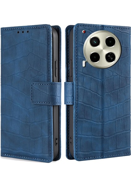 Tecno Camon 30 Mavi Için Skin Fe Timsah Kılıfı (Yurt Dışından)