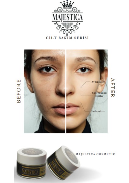 Cilt Tonu Eşitlemeye Yardımcı Ve Aydınlatıcı Yüz Kremi 50 ml modelleri