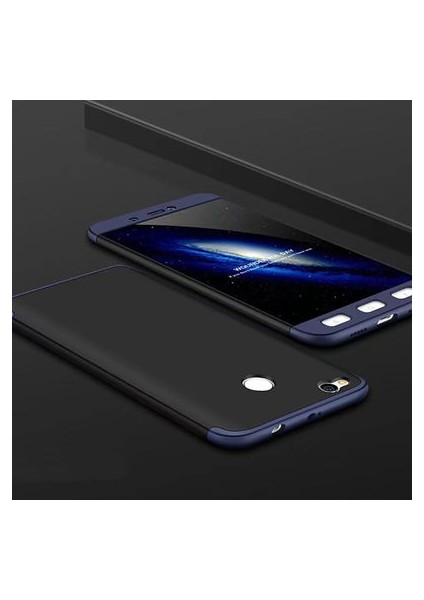 Redmi 4x Kılıf Altı ve Üstü Sökülebilir Sert Bossy Premium Kapak