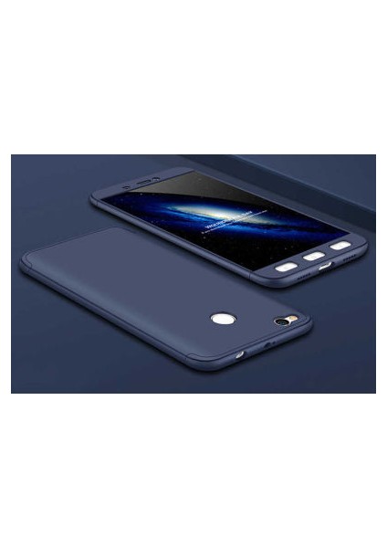 Redmi 4x Kılıf Altı ve Üstü Sökülebilir Sert Bossy Premium Kapak
